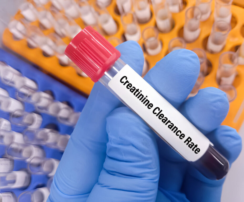 Blood in urine / hematuria treatment