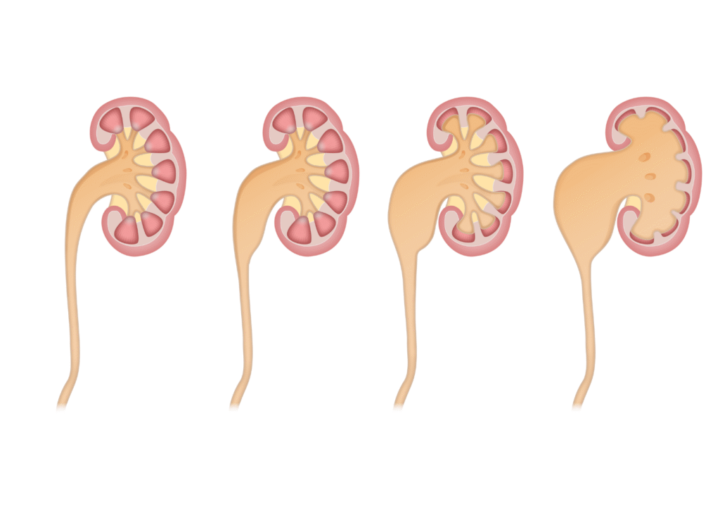 Pediatric Nephrologist Pune