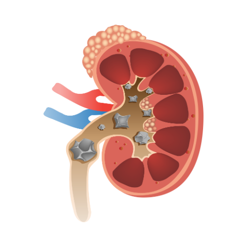 Pediatric kidney specialist
