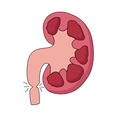Child Kidney Specialist Pune